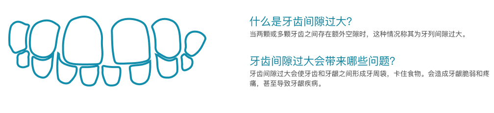牙齿间隙过大介绍