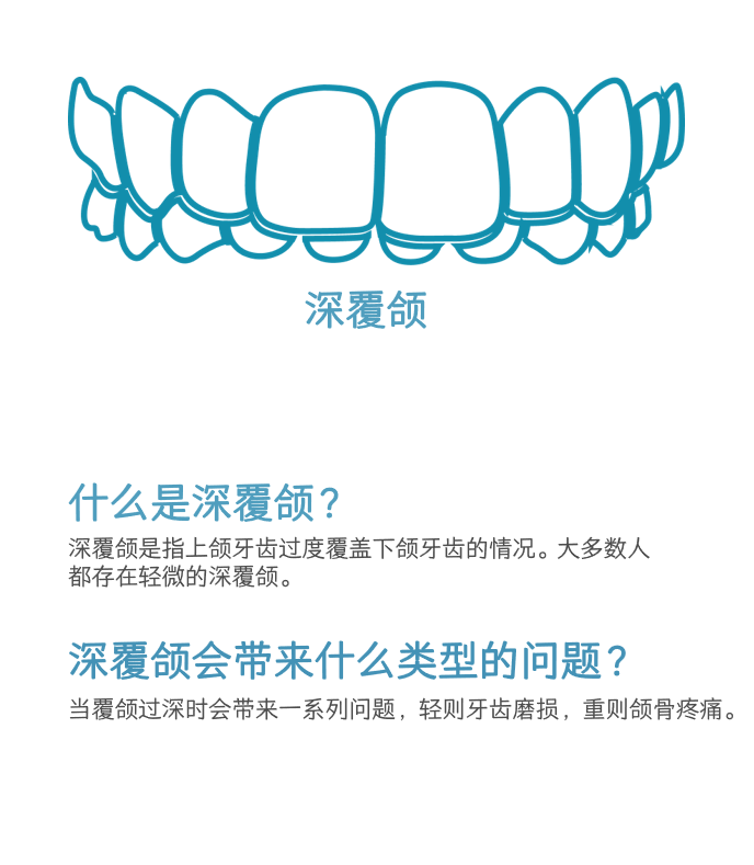 深覆颌介绍图示