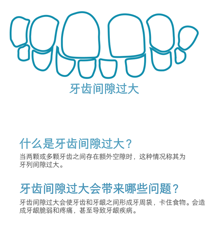 牙齿间隙过大介绍